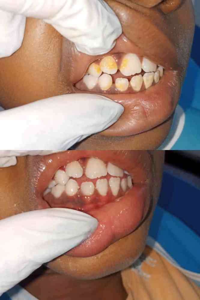 Novacare Dental & Maxillofacial Surgery